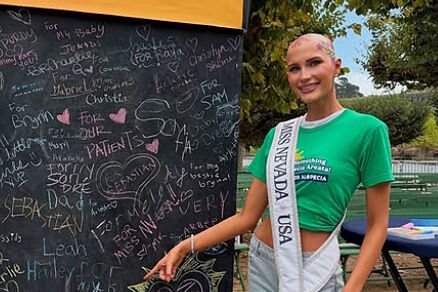 La historia dela aspirante a Miss Estados Unidos con alopecia que se desprendió de su peluca en pleno certamen