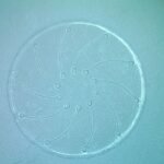 Crean un «ojo inteligente» que se medica a sí mismo y mantiene el glaucoma a raya