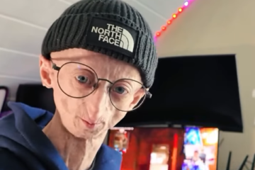 Muere a los 28 años el influencer belga Michiel Vandeweert tras una vida dando visibilidad a la progeria