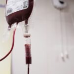 La técnica que limpia el colesterol de la sangre también elimina «químicos eternos» y microplásticos