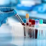 Un análisis de sangre común puede dar la pista sobre el riesgo de demencia futura